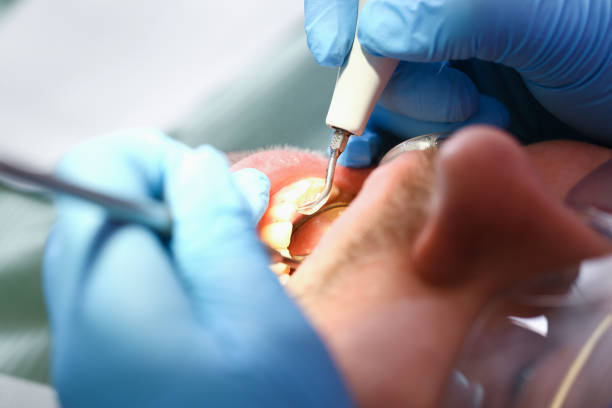 Best Emergency Care for Gum Disease in Monticello, WI