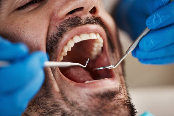 Best Broken or Chipped Tooth Repair in Monticello, WI